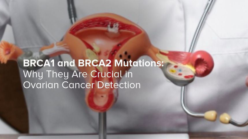 BRCA1 and BRCA2 Mutations: Why They Are Crucial in Ovarian Cancer Detection